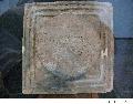 Metal Artifact